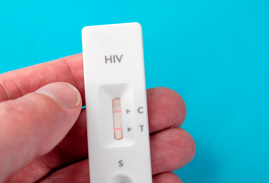 At-home HIV testing kit